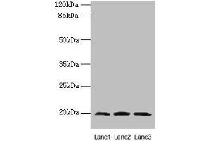 Western blot All lanes: MRPL49 antibody at 0. (MRPL49 抗体  (AA 1-166))