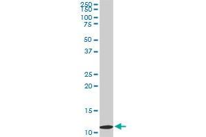 TIMM9 monoclonal antibody (M01), clone 1D6. (TIMM9 抗体  (AA 1-89))