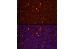 Immunofluorescence analysis of rat spleen cells using RANKL Rabbit pAb (ABIN3016237, ABIN3016238, ABIN3016239 and ABIN6219648) at dilution of 1:100 (40x lens). (RANKL 抗体  (AA 78-317))