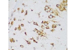 Immunohistochemistry (Paraffin-embedded Sections) (IHC (p)) image for anti-Metadherin (MTDH) antibody (ABIN7261844)