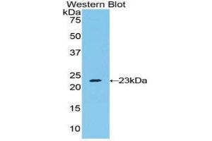Western Blotting (WB) image for anti-RAD54-Like 2 (RAD54L2) (AA 638-837) antibody (ABIN1860395) (ARIP4 抗体  (AA 638-837))