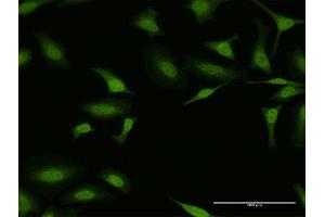 Immunofluorescence of purified MaxPab antibody to ESR1 on HeLa cell.
