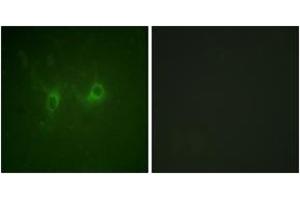 Immunofluorescence analysis of COS7 cells, using RGS16 (Ab-168) Antibody. (RGS16 抗体  (AA 141-190))