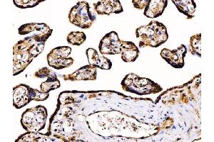IHC analysis of PDIA6 using anti-PDIA6 antibody (ABIN7600554). (PDIA6 抗体  (AA 20-440))