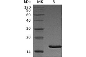 Western Blotting (WB) image for Thymic Stromal Lymphopoietin (TSLP) (Active) protein (His tag) (ABIN7321026) (Thymic Stromal Lymphopoietin Protein (TSLP) (His tag))