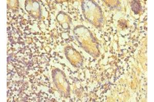 Immunohistochemistry of paraffin-embedded human small intestine tissue using ABIN7164900 at dilution of 1:100 (TAC1 抗体  (AA 1-129))