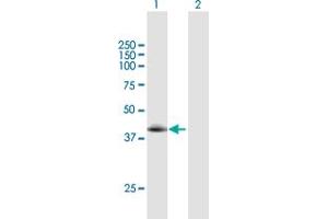 Western Blot analysis of TLL1 expression in transfected 293T cell line by TLL1 MaxPab polyclonal antibody. (TLL1 抗体  (AA 1-392))