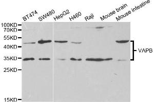 Western blot analysis of extracts of various cell lines, using VAPB antibody (ABIN5973099) at 1/1000 dilution. (VAPB 抗体)