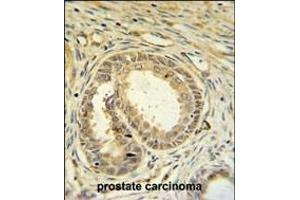 Immunohistochemistry (Paraffin-embedded Sections) (IHC (p)) image for anti-Speedy Homolog A (SPDYA) (AA 147-175) antibody (ABIN6244012)