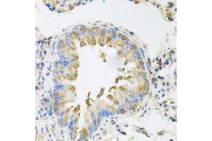 Immunohistochemistry of paraffin-embedded mouse lung using NCR3 antibody (ABIN5974302) at dilution of 1/100 (40x lens). (NCR3 抗体)