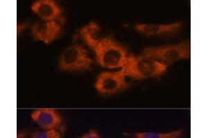 Immunofluorescence analysis of C6 cells using NDRG4 Polyclonal Antibody at dilution of 1:100. (NDRG4 抗体)