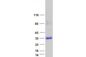 Western Blotting (WB) image for Crystallin, lambda 1 (CRYL1) protein (Myc-DYKDDDDK Tag) (ABIN2724472)