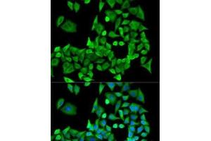 Immunofluorescence analysis of U2OS cells using PPP2R1A Polyclonal Antibody (PPP2R1A 抗体)