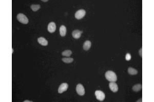 Immunofluorescent staining of A549 cells. (TOP2B 抗体  (AA 1281-1494))
