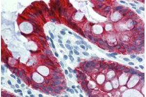 Colon, Human: Formalin-Fixed, Paraffin-Embedded (FFPE) (Cytokeratin 18 抗体)