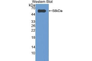 Western blot analysis of the recombinant protein. (CASP14 抗体  (AA 17-248))