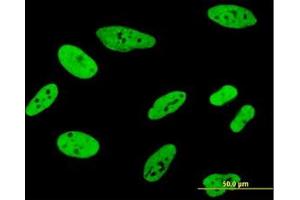 Image no. 5 for anti-Far Upstream Element (FUSE) Binding Protein 1 (FUBP1) (AA 27-137) antibody (ABIN599075) (FUBP1 抗体  (AA 27-137))