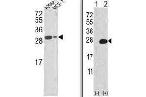 Image no. 1 for anti-Adenine Phosphoribosyltransferase (APRT) (N-Term) antibody (ABIN452753) (APRT 抗体  (N-Term))