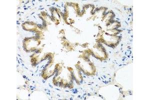 Immunohistochemistry of paraffin-embedded Rat lung using S100A7 Polyclonal Antibody at dilution of 1:100 (40x lens). (S100A7 抗体)