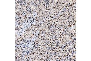 IHC analysis of SNRNP200 using anti-SNRNP200 antibody (ABIN7602032). (SNRNP200 抗体  (AA 557-2129))