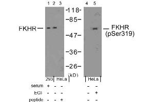 Image no. 1 for anti-Forkhead Box O1 (FOXO1) (Ser319) antibody (ABIN197367) (FOXO1 抗体  (Ser319))