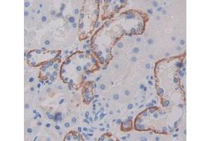 Used in DAB staining on fromalin fixed paraffin- embedded kidney tissue (PLSCR4 抗体  (AA 1-303))