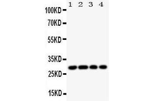 Western Blotting (WB) image for anti-Major Histocompatibility Complex, Class II, DM beta (HLA-DMB) (AA 81-100), (Middle Region) antibody (ABIN3044175) (HLA-DMB 抗体  (Middle Region))