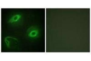Immunofluorescence analysis of HeLa cells, using LATH antibody. (BPIFA4P 抗体)