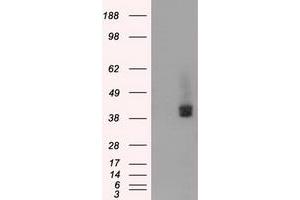 HEK293T cells were transfected with the pCMV6-ENTRY control (Left lane) or pCMV6-ENTRY BSG (Right lane) cDNA for 48 hrs and lysed. (CD147 抗体)