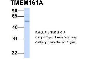 Host:  Rabbit  Target Name:  TMEM161A  Sample Type:  Human Fetal Lung  Antibody Dilution:  1. (TMEM161A 抗体  (Middle Region))