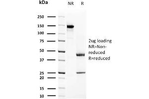 SDS-PAGE Analysis Purified Prolactin Mouse Monoclonal Antibody (PRL/2644). (Prolactin 抗体  (AA 63-201))