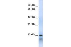 Image no. 1 for anti-Polymerase (RNA) III (DNA Directed) Polypeptide H (22.9kD) (POLR3H) (C-Term) antibody (ABIN6743479) (POLR3H 抗体  (C-Term))