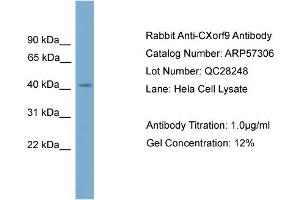 WB Suggested Anti-CXorf9  Antibody Titration: 0. (SASH3 抗体  (C-Term))