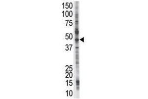 Image no. 1 for anti-Proteasome (Prosome, Macropain) 26S Subunit, Non-ATPase, 4 (Psmd4) (C-Term) antibody (ABIN357468)