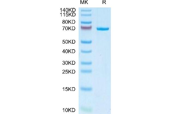 alpha Fetoprotein Protein (AA 19-609) (His tag)