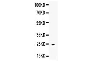 Western Blotting (WB) image for anti-Tumor Necrosis Factor (Ligand) Superfamily, Member 4 (TNFSF4) (AA 49-198) antibody (ABIN5693081)