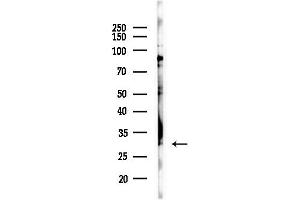 Western blot analysis of lysates from PC12 cells(LPS,4h treatment), using CLIC4 Antibody at 1/1000 dilution.