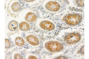 ABIN6258133 and ABIN6275167 at 1/100 staining human normal colon tissue by IHC-P. (ERAS 抗体  (C-Term))