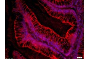 Paraformaldehyde-fixed, paraffin embedded human colon cancer, Antigen retrieval by boiling in sodium citrate buffer (pH6) for 15min, Block endogenous peroxidase by 3% hydrogen peroxide for 30 minutes, Blocking buffer (normal goat serum) at 37°C for 20min, Antibody incubation with 	Rabbit Anti-FZD3/Frizzled 3 Polyclonal Antibody, Unconjugated ( 	 ) at 1:200 overnight at 4°C, followed by the secondary antibody was Goat Anti-Rabbit IgG, Cy3 conjugated-Cy)and used at 1:200 dilution for 40 minutes at 37°CDAPI(5ug/ml) was used to stain the cell nuclei (FZD3 抗体  (AA 121-220))