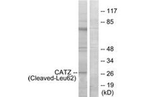 Western blot analysis of extracts from COS7 cells, treated with etoposide 25uM 1h, using CATZ (Cleaved-Leu62) Antibody. (Cathepsin Z 抗体  (Cleaved-Leu62))