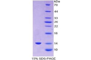 SDS-PAGE (SDS) image for Angiogenic Factor with G Patch and FHA Domains 1 (AGGF1) ELISA Kit (ABIN6720601)