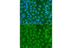 Immunofluorescence analysis of A-549 cells using CXXC1 antibody. (CXXC1 抗体  (AA 1-210))