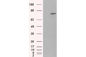 HEK293 overexpressing Human PDE4B and probed with ABIN2564508 (mock transfection in first lane). (PDE4B 抗体  (C-Term))