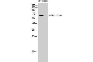 Western Blotting (WB) image for anti-Estrogen Receptor 1 (ESR1) (pSer106) antibody (ABIN3172892) (Estrogen Receptor alpha 抗体  (pSer106))