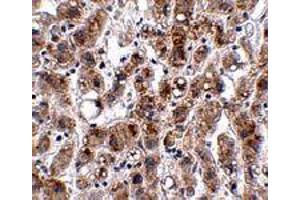 Immunohistochemistry of ACOT13 in human liver tissue with ACOT13 polyclonal antibody  at 2. (THEM2 抗体  (C-Term))