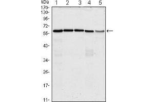 Western blot analysis using anti-CDC25C mAb against Hela (1), K562 (2), PC-3 (3), HEK293 (4) and Raw264. (CDC25C 抗体)