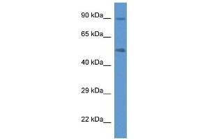 Western Blotting (WB) image for anti-Cytochrome P450, Family 2, Subfamily W, Polypeptide 1 (CYP2W1) (C-Term) antibody (ABIN926601)