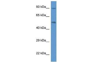 Western Blot showing CYP2W1 antibody used at a concentration of 1 ug/ml against Fetal Lung Lysate (CYP2W1 抗体  (C-Term))