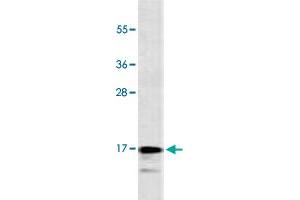 Western Blot analysis of CEM cell lysate (35 ug/lane) with CALCA monoclonal antibody, clone 406CT21. (CGRP 抗体  (AA 56-84))