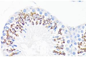 Immunohistochemistry of paraffin-embedded Mouse testis using CAMP Polyclonal Antibody at dilution of 1:200 (40x lens). (Cathelicidin 抗体)